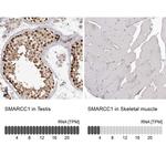 SMARCC1 Antibody
