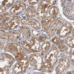 LAMTOR3 Antibody in Immunohistochemistry (Paraffin) (IHC (P))