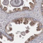 LAMTOR3 Antibody in Immunohistochemistry (Paraffin) (IHC (P))
