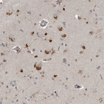 LAMTOR3 Antibody in Immunohistochemistry (Paraffin) (IHC (P))