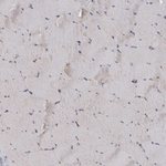 LAMTOR3 Antibody in Immunohistochemistry (Paraffin) (IHC (P))