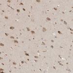 CCPG1 Antibody in Immunohistochemistry (Paraffin) (IHC (P))