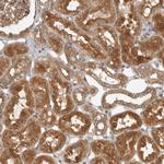 CCPG1 Antibody in Immunohistochemistry (Paraffin) (IHC (P))