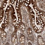 CCPG1 Antibody in Immunohistochemistry (Paraffin) (IHC (P))