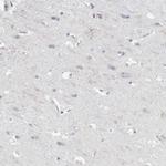 ABHD12 Antibody in Immunohistochemistry (Paraffin) (IHC (P))