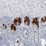 ABHD12 Antibody in Immunohistochemistry (Paraffin) (IHC (P))