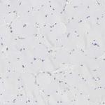 ABHD12 Antibody in Immunohistochemistry (Paraffin) (IHC (P))