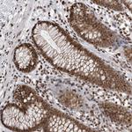 YAF2 Antibody in Immunohistochemistry (Paraffin) (IHC (P))