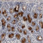CCDC126 Antibody in Immunohistochemistry (Paraffin) (IHC (P))