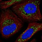 SLC25A26 Polyclonal Antibody