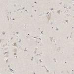 SLC25A26 Antibody in Immunohistochemistry (IHC)