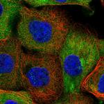 NCEH1 Polyclonal Antibody