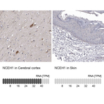 NCEH1 Antibody in Immunohistochemistry (Paraffin) (IHC (P))