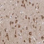 NCEH1 Antibody in Immunohistochemistry (Paraffin) (IHC (P))