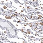 NCEH1 Antibody in Immunohistochemistry (Paraffin) (IHC (P))