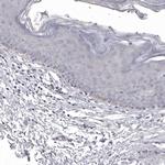 NCEH1 Antibody in Immunohistochemistry (Paraffin) (IHC (P))