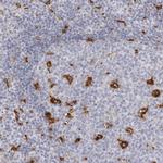 NCEH1 Antibody in Immunohistochemistry (Paraffin) (IHC (P))