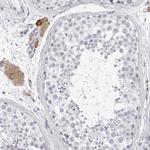 SMIM2 Polyclonal Antibody