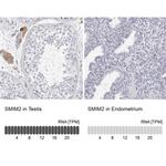 SMIM2 Antibody in Immunohistochemistry (IHC)