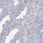 SMIM2 Antibody in Immunohistochemistry (IHC)