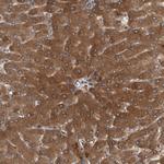 Parp11 Polyclonal Antibody