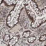 WDR33 Polyclonal Antibody