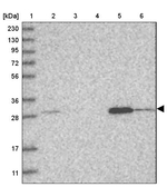 WDR33 Antibody in Western Blot (WB)