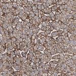 GLT8D2 Antibody in Immunohistochemistry (Paraffin) (IHC (P))