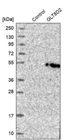 GLT8D2 Antibody in Western Blot (WB)