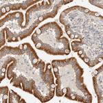C12orf49 Antibody in Immunohistochemistry (Paraffin) (IHC (P))