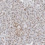 COPS7A Antibody in Immunohistochemistry (Paraffin) (IHC (P))