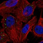 PIGP Polyclonal Antibody