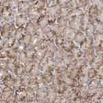 PIGP Antibody in Immunohistochemistry (Paraffin) (IHC (P))