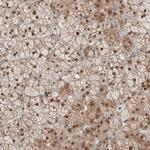 MPHOSPH6 Antibody in Immunohistochemistry (IHC)