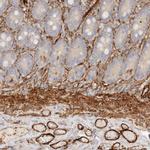 TMTC2 Antibody in Immunohistochemistry (IHC)