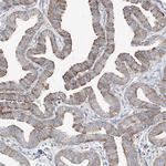 CRELD1 Antibody in Immunohistochemistry (Paraffin) (IHC (P))