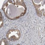 CMTM6 Antibody in Immunohistochemistry (IHC)