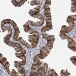 CMTM6 Antibody in Immunohistochemistry (IHC)