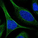 TCTN3 Polyclonal Antibody
