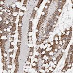TCTN3 Antibody in Immunohistochemistry (IHC)