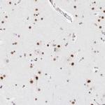 C1orf162 Antibody in Immunohistochemistry (Paraffin) (IHC (P))