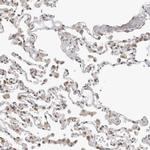 C1orf162 Antibody in Immunohistochemistry (Paraffin) (IHC (P))