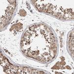 PARP6 Antibody in Immunohistochemistry (Paraffin) (IHC (P))