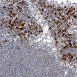 TMEM69 Antibody in Immunohistochemistry (IHC)