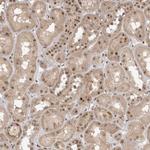 POMP Antibody in Immunohistochemistry (Paraffin) (IHC (P))