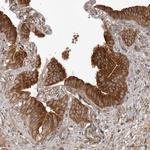 ARL5A Polyclonal Antibody