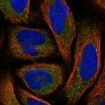 SRD5A3 Polyclonal Antibody