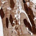 VN1R4 Polyclonal Antibody