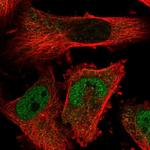 TMPPE Polyclonal Antibody