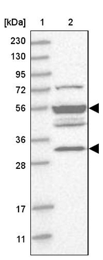 TMPPE Antibody in Western Blot (WB)